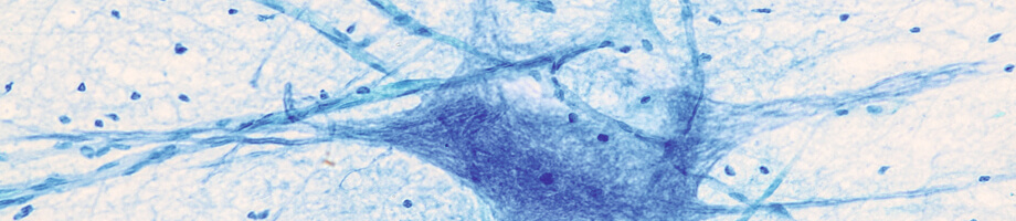 Derde vededigingslinie van het afweersysteem