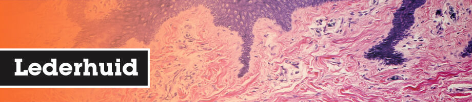 Lederhuid Lederhuid