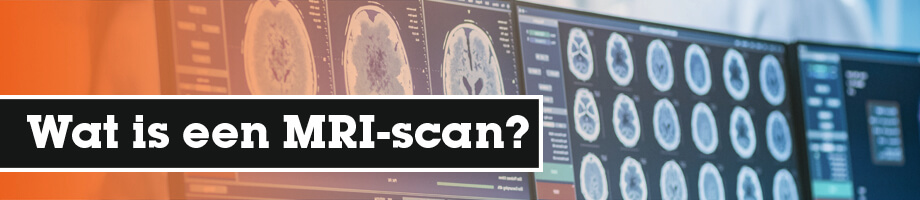 Wat is een MRI-scan?