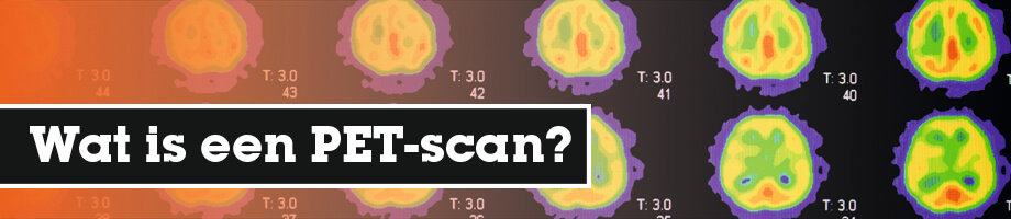 Wat is een PET-scan?