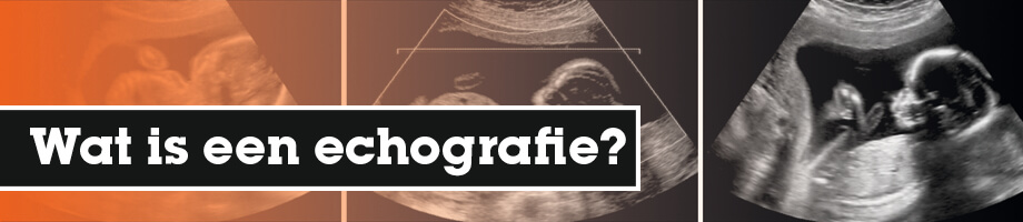 Wat is een echografie?
